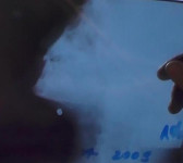 На прогулке в детском саду мальчик получил травму, нанесенную пулей от пневматического оружия