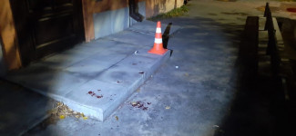 Ирбитчанин решил прокатиться на электросамокате и оказался в операционной ЦГБ г. Ирбита