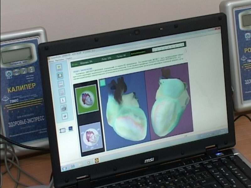 Кардиограмма - дистанционно