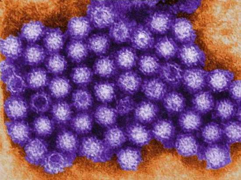 Норовирусная инфекция - это опасное заболевание!