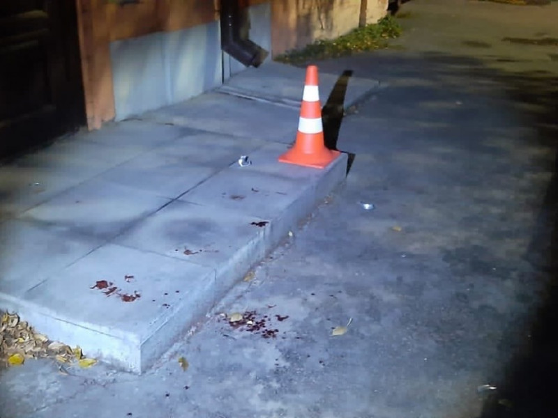 Ирбитчанин решил прокатиться на электросамокате и оказался в операционной ЦГБ г. Ирбита